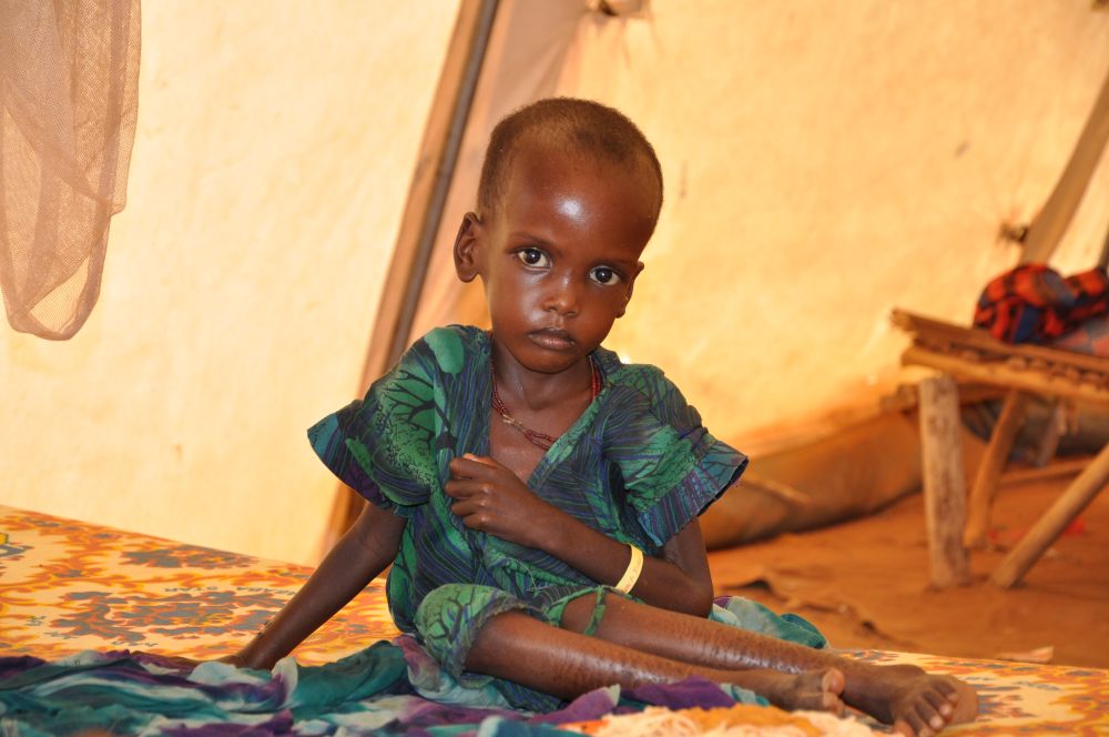 Titelbild: Ein hungerndes Kind in Äthiopien (Cate Turton/Department for International Development; Lizenz: CC BY 2.0)