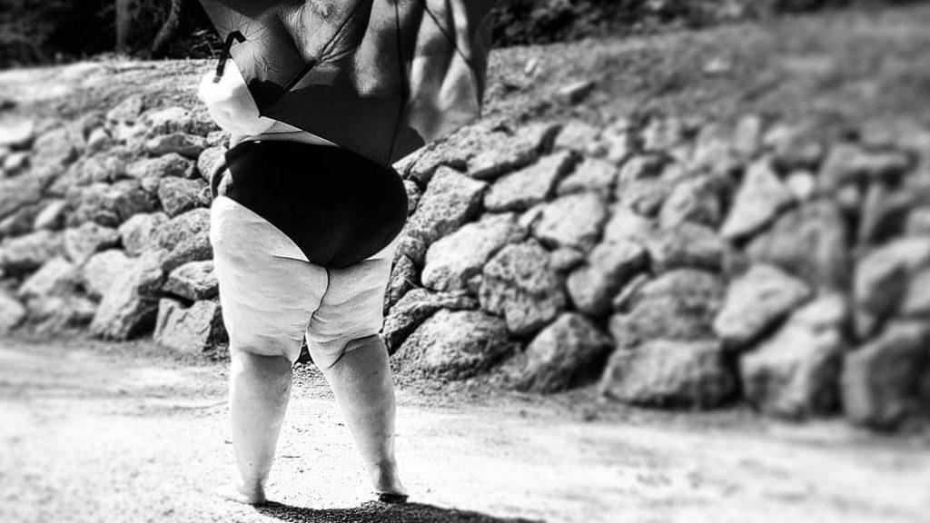 Lipödem-Betroffen mit dem Rücken zur Kamera, hält Schirm in der Hand